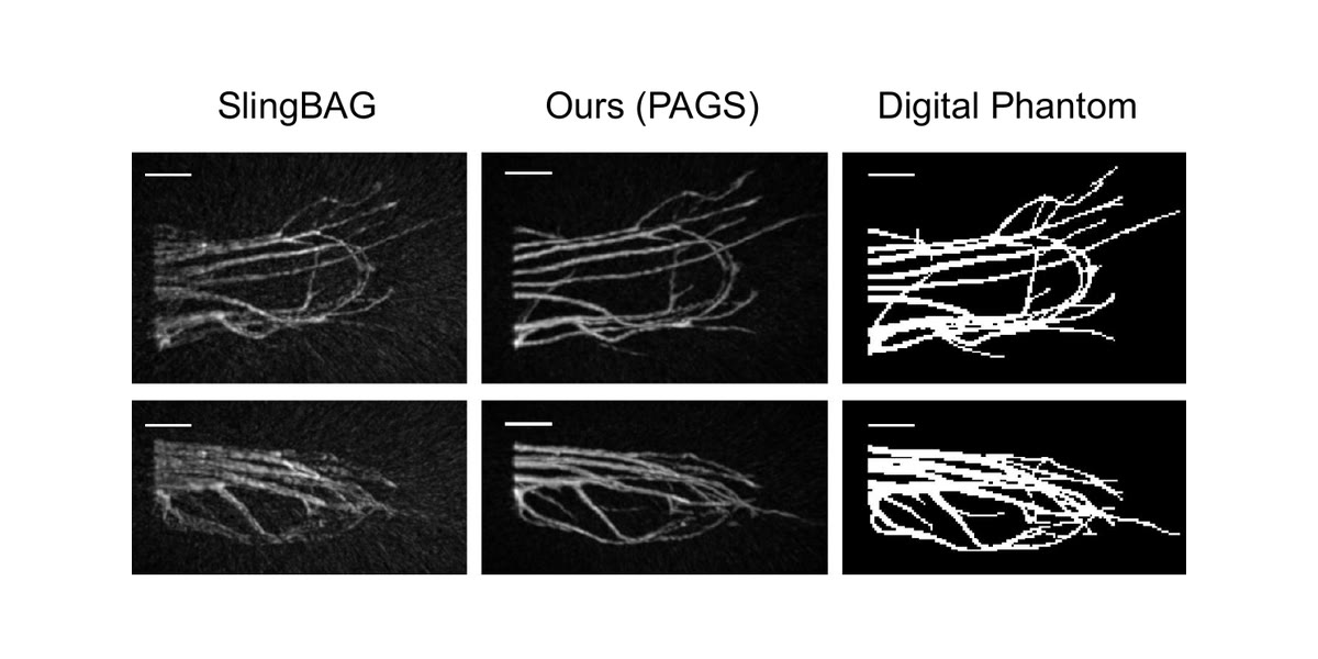 Two rows of photoacoustic reconstructions of a branching vascular phantom, shown for SlingBAG, for PAGS, and as the ground-truth digital phantom. The SlingBAG panels carry a mottled noise floor around the vessels; the PAGS panels are cleaner, with the vessel network closer to the crisp white tracery of the phantom
